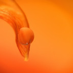 Wassertropfen am Ende eines Tulpenblatts